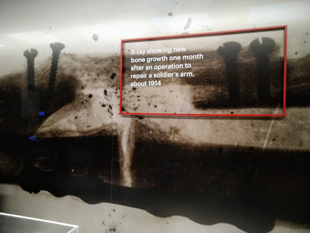 Medicine: Wellcome Galleries. La più grande esposizione al mondo dedicata alla&nbsp;medicina.